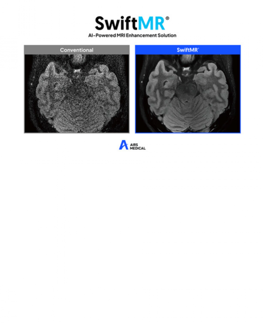 [에어스메디컬] 서울대병원에 AI 솔루션 '스위프트엠알' 공급